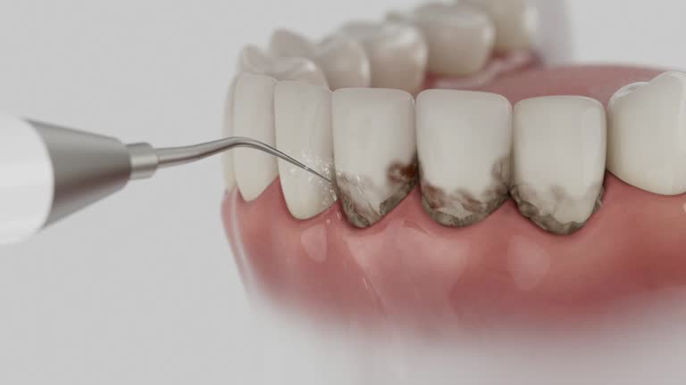 Trusted Teeth Whitening service in Parkville, MD - Dentist Open Now